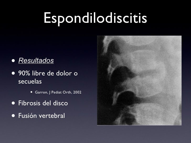 espondilodiscitis lumbar